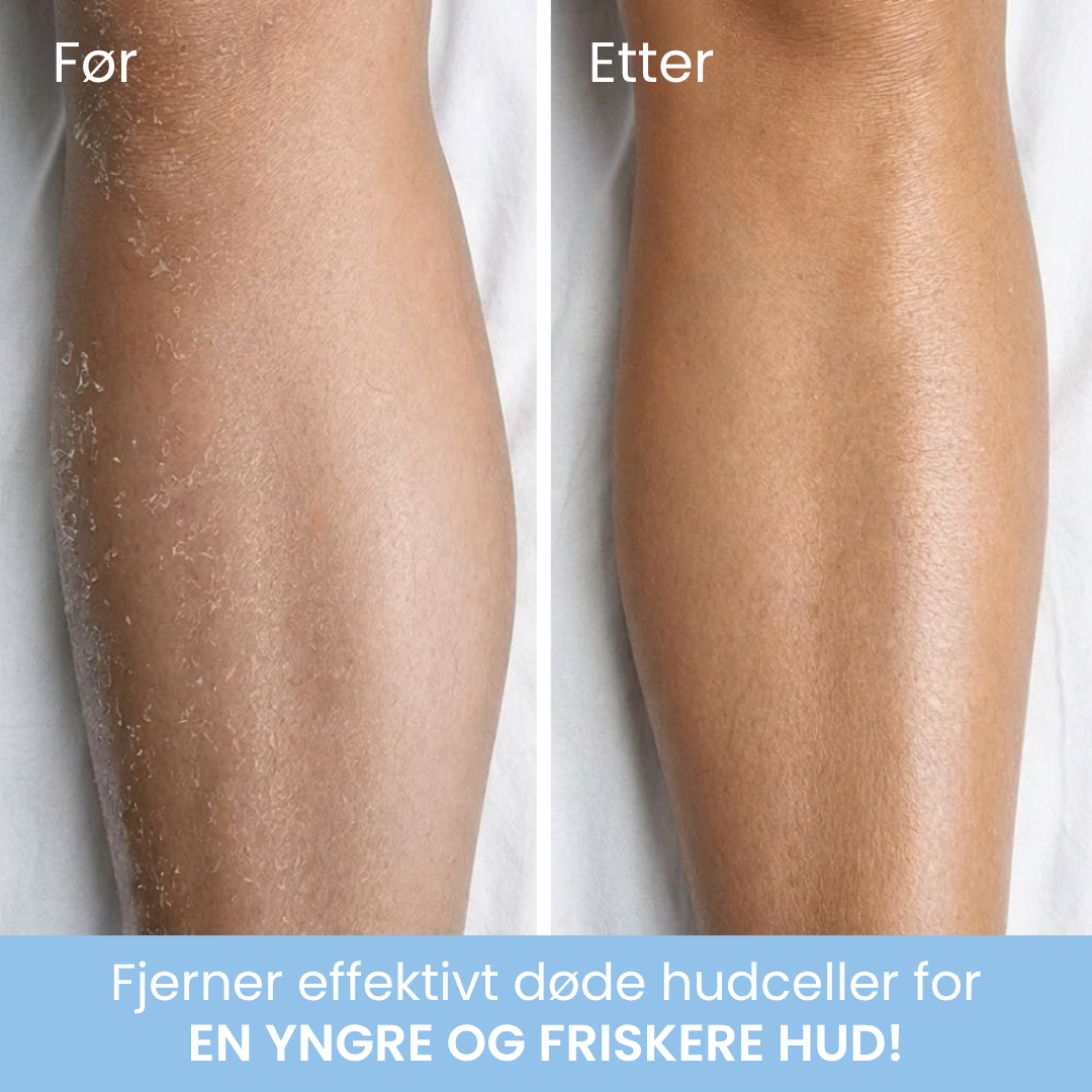Blissy™ Body Peel Glove – Eksfolierende hanske